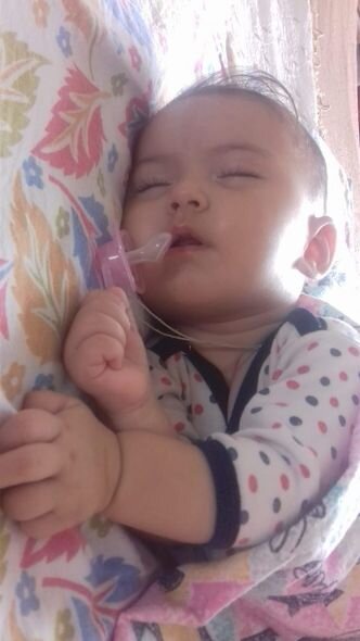 Başında kista olan səkkiz aylıq körpənin yardıma ehtiyacı var - FOTO