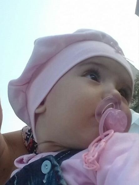 Başında kista olan səkkiz aylıq körpənin yardıma ehtiyacı var - FOTO