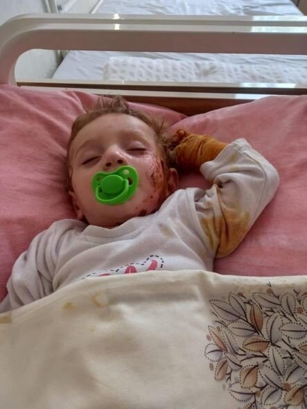 Üzərinə qaynar termos aşırdan Ağamuradın dəstəyə ehtiyacı var - FOTO