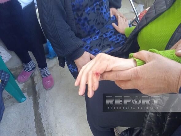 Bərdədə döşəmənin çökməsi nəticəsində xəsarət alanların sayı artıb - YENİLƏNİB + FOTO