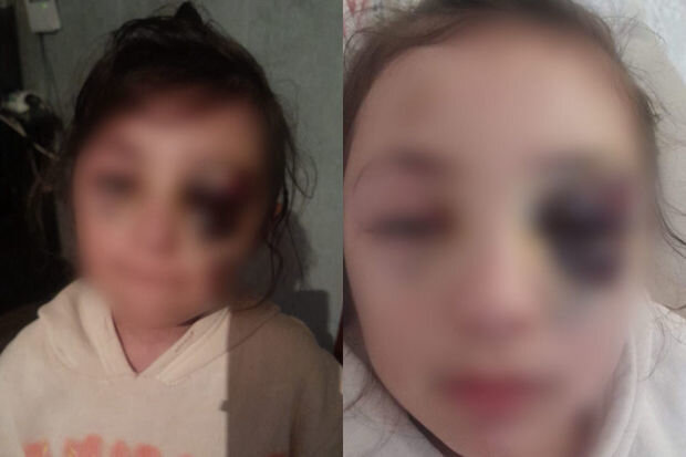 Döyüldüyü iddia edilən məktəblinin anası bəzi məqamlara aydınlıq gətirdi - YENİLƏNİB + VİDEO