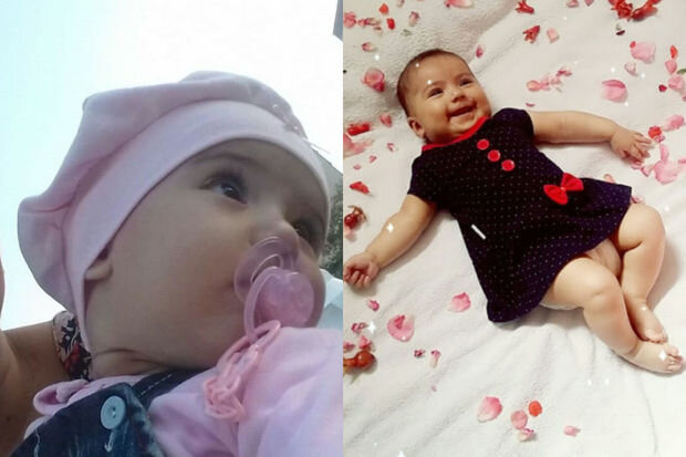 Başında kista olan səkkiz aylıq körpənin yardıma ehtiyacı var - FOTO