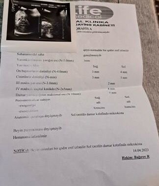 Başında kista olan səkkiz aylıq körpənin yardıma ehtiyacı var - FOTO