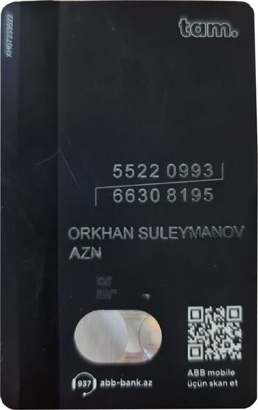 10 aylıq körpənin dəstəyinizə ehtiyacı var: Təcili əməliyyat olunmalıdır - FOTO