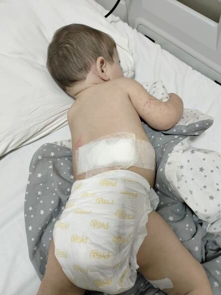 10 aylıq körpənin dəstəyinizə ehtiyacı var: Təcili əməliyyat olunmalıdır - FOTO