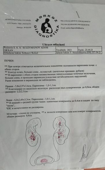 10 aylıq körpənin dəstəyinizə ehtiyacı var: Təcili əməliyyat olunmalıdır - FOTO