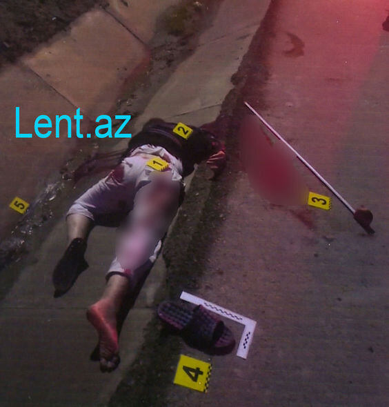 Rəşad Dağlı: "Pul versəydim "üzdən iraq" olmayacaqdım" - FOTO/VİDEO