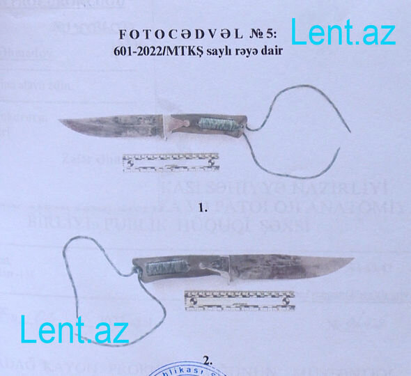 Rəşad Dağlı: "Pul versəydim "üzdən iraq" olmayacaqdım" - FOTO/VİDEO