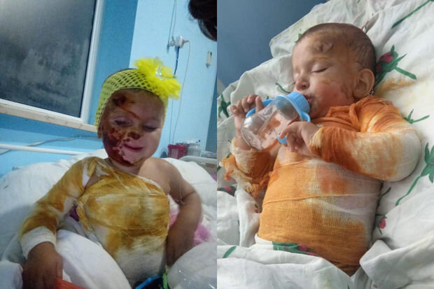 Balaca Zəhranın anası fəryad edir: "Bint almağa pulum yoxdur, sarğılarını 4 gündür dəyişə bilmirəm" - FOTO