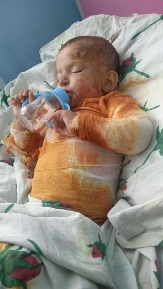 Balaca Zəhranın anası fəryad edir: "Bint almağa pulum yoxdur, sarğılarını 4 gündür dəyişə bilmirəm" - FOTO