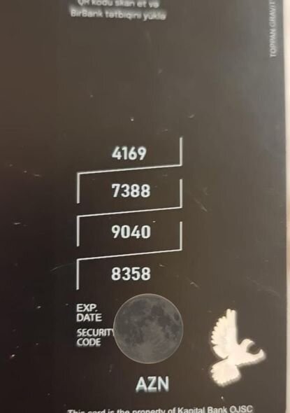 Nadir anadangəlmə anomaliyadan əziyyət çəkən Tuncayın anasından YARDIM ÇAĞIRIŞI - FOTO