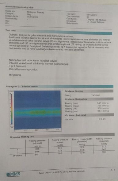 Nadir anadangəlmə anomaliyadan əziyyət çəkən Tuncayın anasından YARDIM ÇAĞIRIŞI - FOTO
