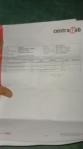 2 yaşlı Həmzənin anası fəryad edir: "Övladıma ət almağa belə pulum yoxdur" - FOTO