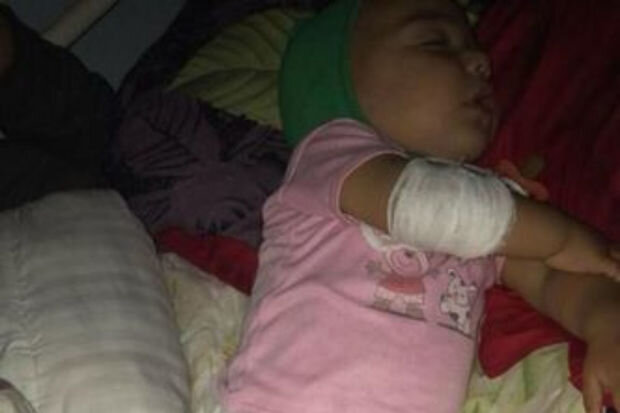 Bədəni yanan körpənin atası fəryad edir: "Dərmanlarını almaq üçün 800 manata ehtiyacımız var" - FOTO