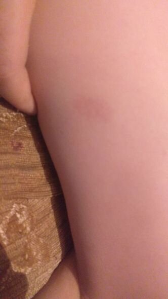 Qonşu 10 yaşlı uşağı vəhşicəsinə döyüb - İDDİA + FOTO/VİDEO