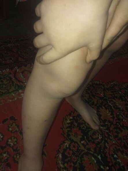 Qonşu 10 yaşlı uşağı vəhşicəsinə döyüb - İDDİA + FOTO/VİDEO