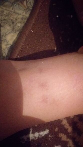 Qonşu 10 yaşlı uşağı vəhşicəsinə döyüb - İDDİA + FOTO/VİDEO