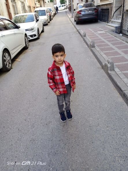 5 yaşlı Cəsurun iki ayı qalıb: "Müalicə üçün maşınımı satdım, əməliyyat üçün pulumuz yoxdur" - FOTO