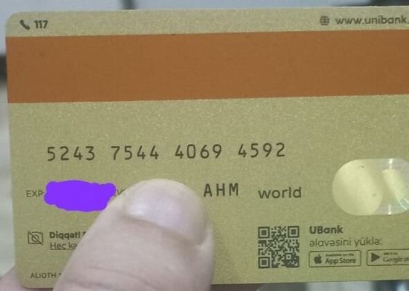 İslamın əməliyyatı üçün 3 200 manata ehtiyac var - FOTO