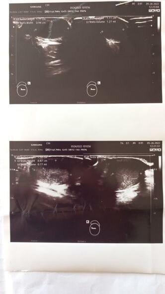 İslamın əməliyyatı üçün 3 200 manata ehtiyac var - FOTO