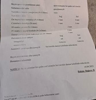 10 aylıq körpənin anası fəryad edir: "Melisa mənim ilk və tək övladımdır, onu itirməkdən qorxuram" - FOTO