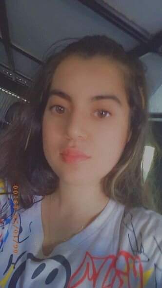 20 yaşlı Ayselin anası fəryad edir: "Övladımı ölümün pənçəsindən xilas etməyiniz üçün yalvarıram" - FOTO