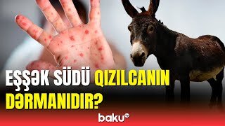 Uzunqulaq südü qızılcaya necə təsir edir? - VİDEO