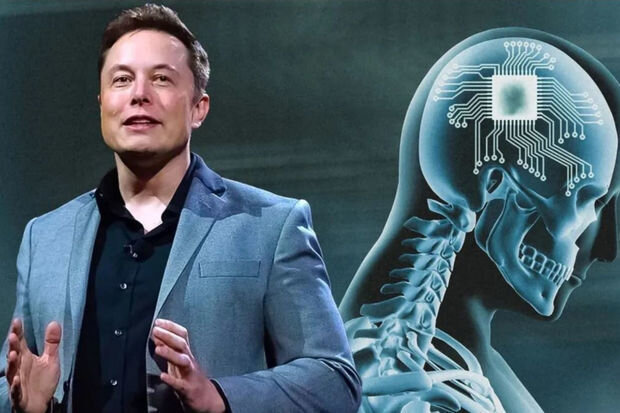 Dünyada bir ilk: İnsan beyninə çip yerləşdirildi - FOTO