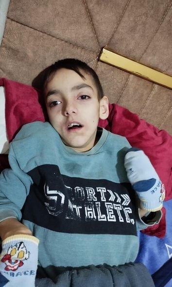 12 yaşlı Ömərin 200 manata ehtiyacı var: Anası yardım diləyir - FOTO