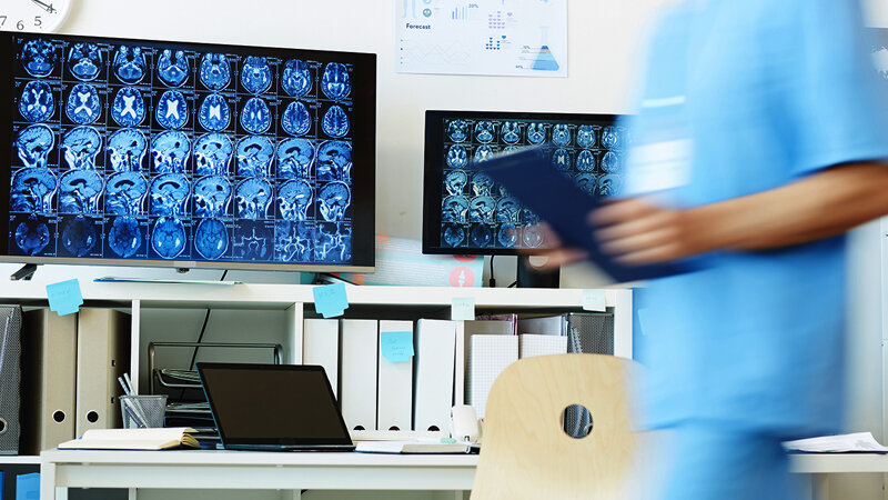 Alimlər insult üçün yeni risk faktoru tapdı