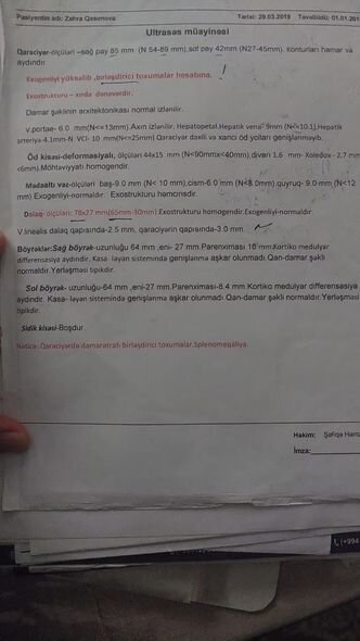 Balaca Zəhranın anası fəryad edir: "O mənim yeganə övladımdır, onu itirməkdən çox qorxuram" - FOTO