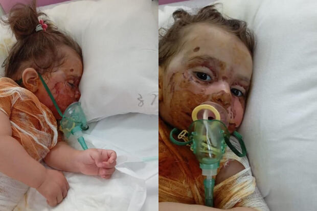 İki yaşlı Narının anası: "Yemək almağa belə pulum qalmayıb" - FOTO