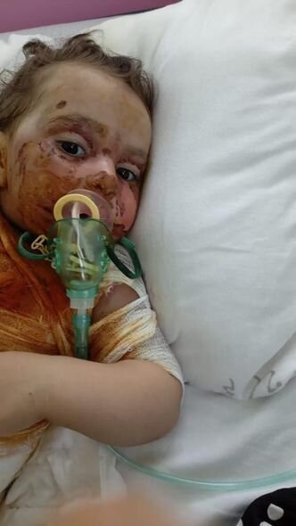 İki yaşlı Narının anası: "Yemək almağa belə pulum qalmayıb" - FOTO