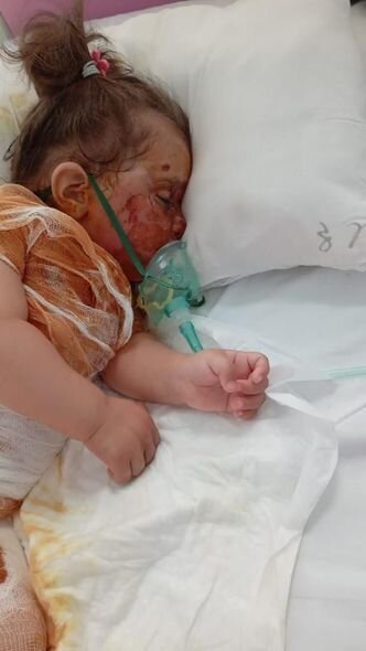 İki yaşlı Narının anası: "Yemək almağa belə pulum qalmayıb" - FOTO