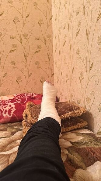 Bakıda "Azəriqaz"ın əməkdaşına xəsarət yetirilib - FOTO