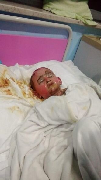 Yanğında xəsarət alan iki yaşlı Zeynəbin sizin köməyinizə ehtiyacı var - FOTO