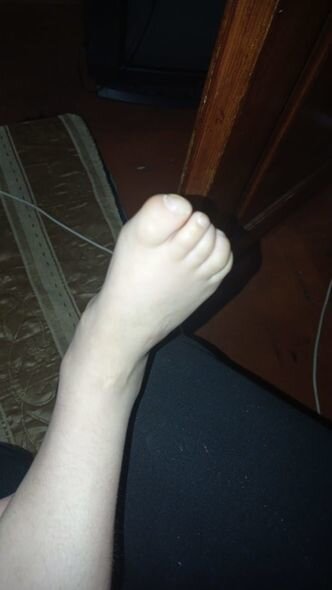 Balaca Məryəmin anası: "Atası xəstəliyini öyrəndiyi gün bizi tərk etdi, əməliyyata imkanımız çatmır" - FOTO