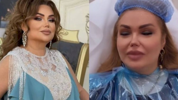 Könül Kərimovadan plastik əməliyyat iddiasına CAVAB