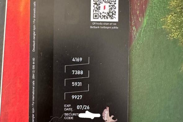 İki yaşlı Asimin əlləri yanıb: Müalicə üçün dəstəyə ehtiyacları var - FOTO