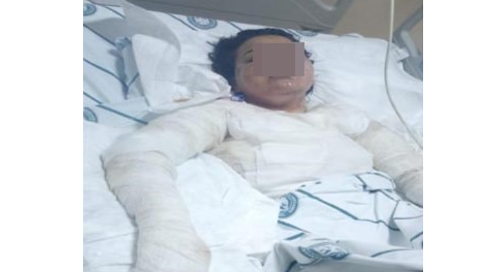 Dəhşət! Qadını əri və qaynı ütü ilə yandırdı - Səbəbi isə