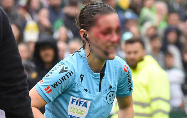 Hakim kamerayla toqquşub, ağır zədə aldı - Fotolar