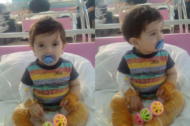 Bədəni yanan bir yaşlı Ömərin dəstəyə ehtiyacı var - FOTO