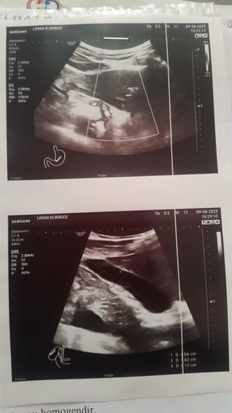 Üç övladı olan İmamalının dəstəyə ehtiyacı var: Müalicələri yarım qalıb - FOTO