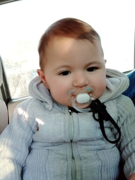 Körpə Nurayın atası: "İmkan olmadığı üçün müalicə yarımçıq qalıb" - FOTO