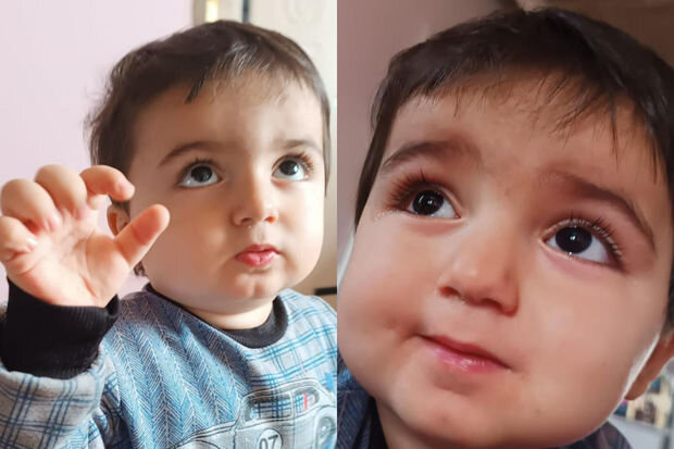 İki yaşlı Raulun anası: "Gün ərzində 3-4 dəfə epilepsiyası tutur" - FOTO