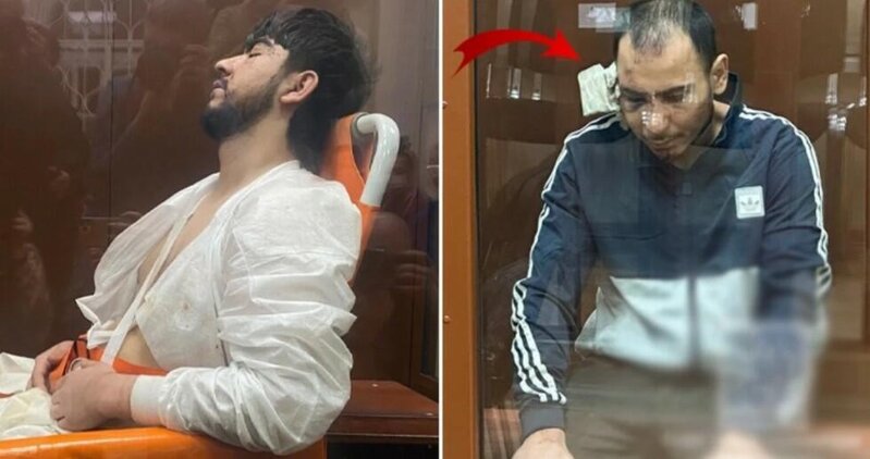 Terrorçuların qulaqları niyə kəsilib? - Hərbi ekspert səbəbini açıqladı