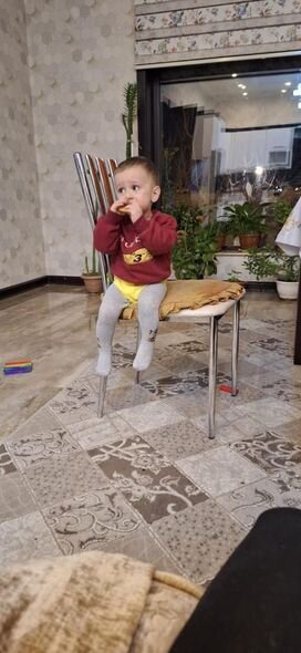 Körpə Hüseyn yardımsevər şəxslərin dəstəyinə möhtacdır: Müalicə üçün 600 manat lazımdır - FOTO