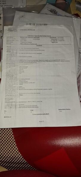 Körpə Hüseyn yardımsevər şəxslərin dəstəyinə möhtacdır: Müalicə üçün 600 manat lazımdır - FOTO