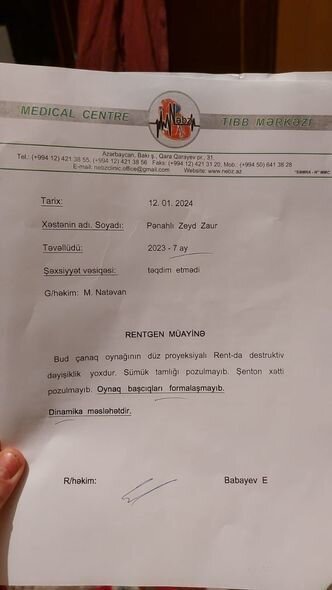 9 aylıq Zeydin müalicəyə ehtiyacı var: "Maddi cəhətdən tam tükənmişik" - FOTO