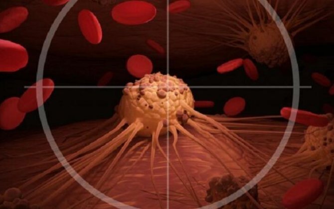 Səhərlər bu 3 əlamət onkologiyanı göstərə bilir - DİQQƏT